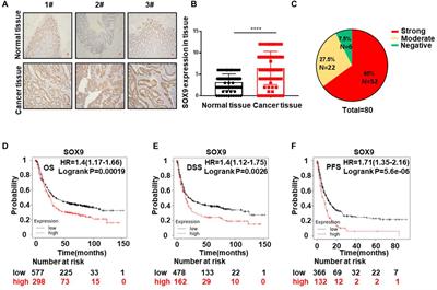 The SOX9-MMS22L Axis Promotes Oxaliplatin Resistance in Colorectal Cancer